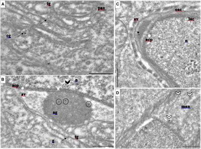 Loss of Profilin3 Impairs Spermiogenesis by Affecting Acrosome Biogenesis, Autophagy, Manchette Development and Mitochondrial Organization